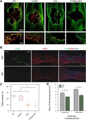 Reverse Adverse Immune Microenvironments by Biomaterials Enhance the Repair of Spinal Cord Injury